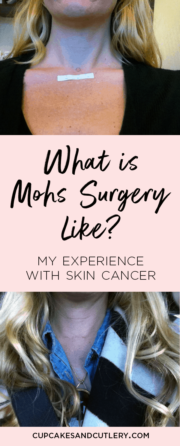Before and after photos of my basal cell carcinoma and my experience with Mohs Surgery. Sharing my personal recovery and how my scar has healed over time. Skin cancer sucks, y'all. #dermatology #cupcakesandcutlery #skincancer #cancerawareness #mohssurgery