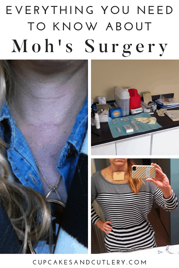 what to know about mohs surgery
