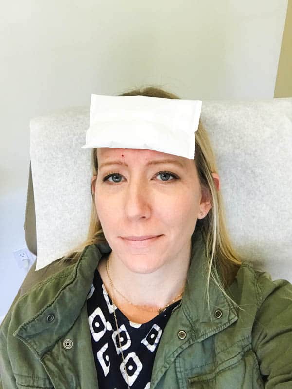 Woman with ice pack on her forehead after getting Botox at CosmetiCare.