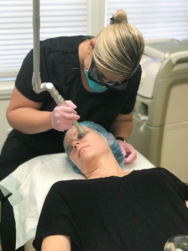 A woman doing a CO2 laser skin resurfacing treatment on another woman at Cosmeticare in Orange County. 