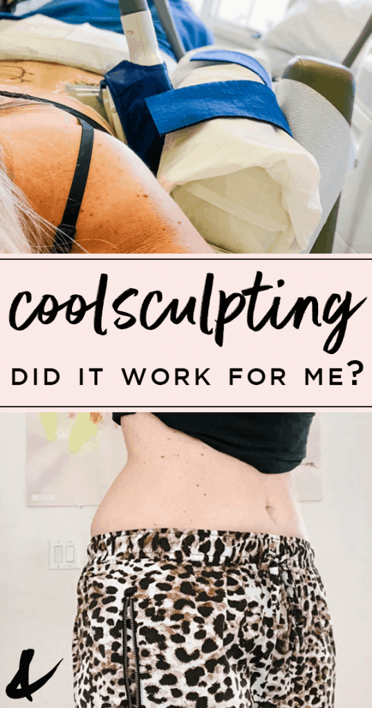 Coolsculpting results with text overlay