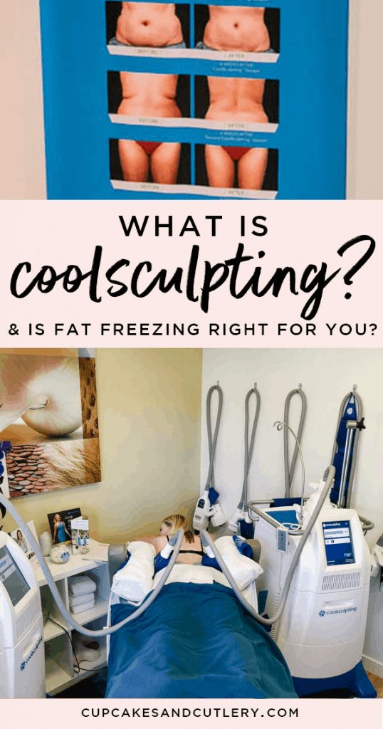 What is coolsculpting and is it right for you with text overlay
