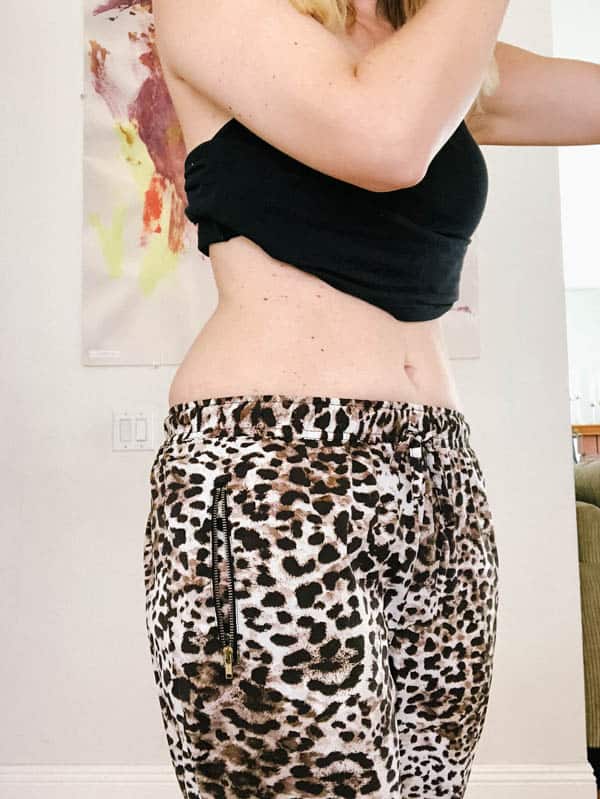 After photo of my love handles to see the results of my Coolsculpting.